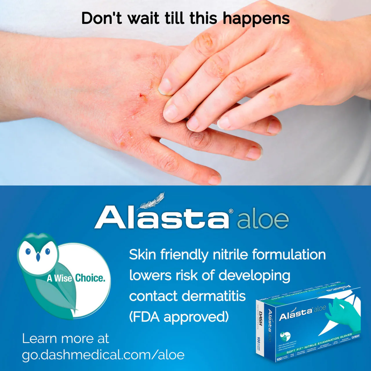 DASH Alasta Aloe Nitrile Exam Grade Disposable Gloves, Chemo Tested, Green, 3.9 mil, Box of 100 - Image 3